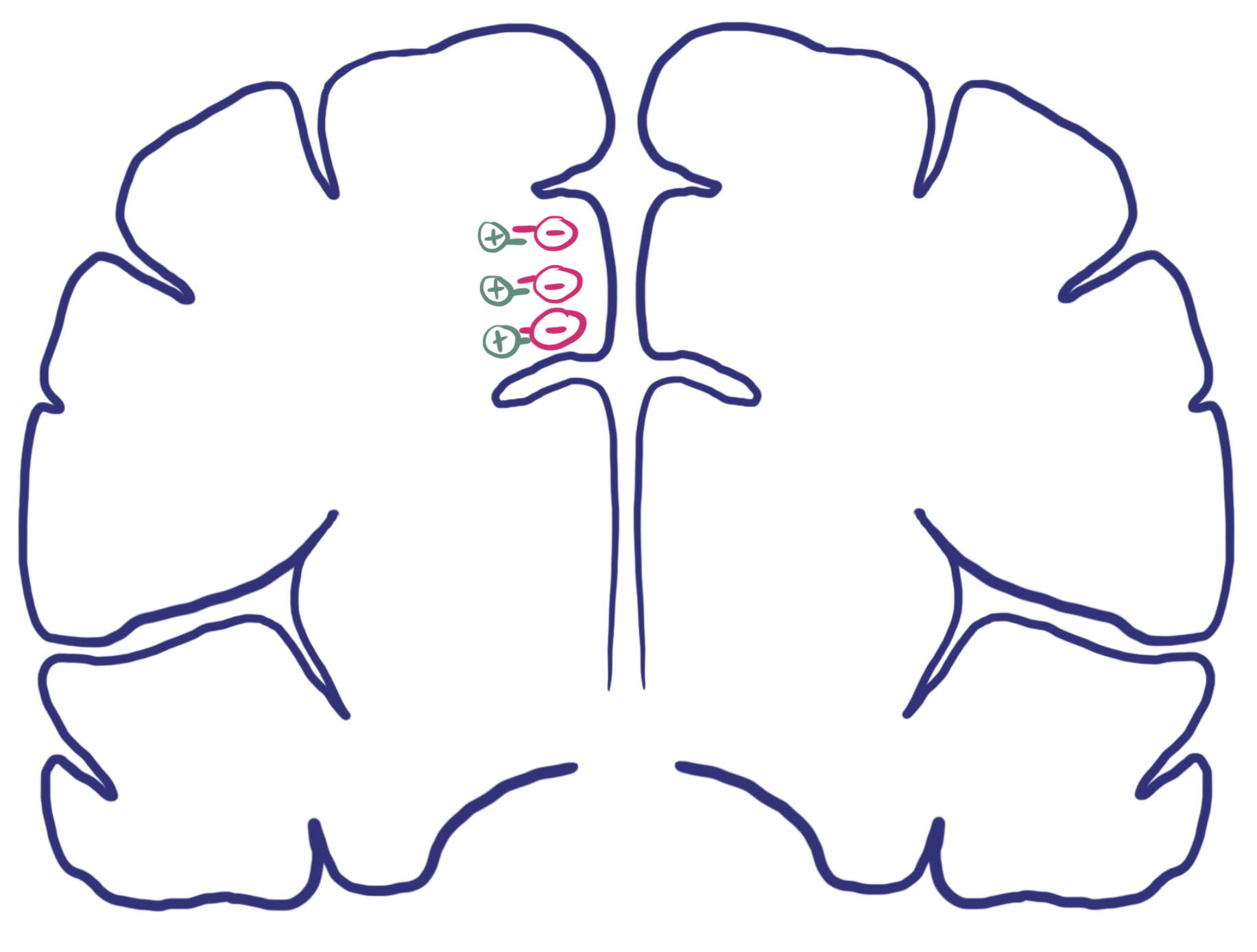 Basic EEG Electrophysiology